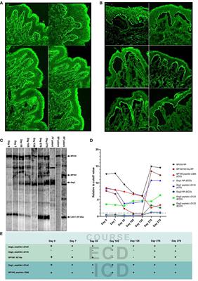 Case Report: Variety of Target Antigens During 1 Year Follow-Up of a Patient Initially Diagnosed With <mark class="highlighted">Bullous Pemphigoid</mark>
